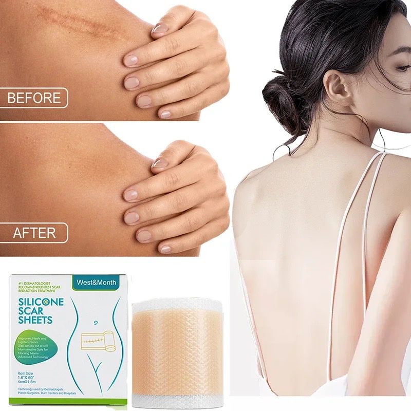 Miniatura 2 de Cinta De Silicona Para Quitar Cicatrices